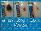 New Hair Care women & men - 2 years clinical trials for increase hair growth
